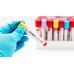 CE Approved Dengue Ns1 Antigen Test Kit Antibody Rapid Test Cassette for sale