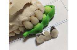 China Porcelain CAD CAM PFM Crown supplier
