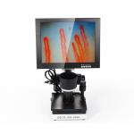 LCD Digital Biological Microscope Microcirculation Checking Capillary Microscope for sale