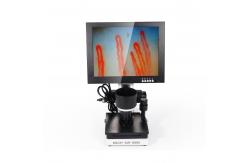 China Portable 10 Inch LED Display Nail Fold Capillaroscopy Microcirculation Test Machine supplier