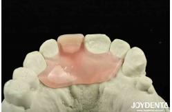 China Personalized Customization Flexible Denture Finish using Tooth Arrangement Technology with Good Elasticity supplier
