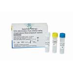 Anti-Sperm antibody IgG detection (MAR method) for sale