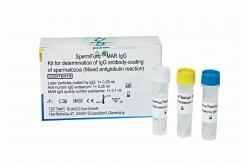 China Anti-Sperm antibody IgG detection (MAR method) supplier