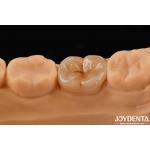 High Precision Applications Full Zirconia With High Resistance To Thermal Shock