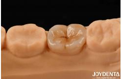 China High Precision Applications Full Zirconia With High Resistance To Thermal Shock supplier