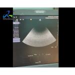 Siemens S1000 Ultrasound Machine Repair Service No Image And Waveform In Mode And Can'T Switch To 14L5 Probe for sale