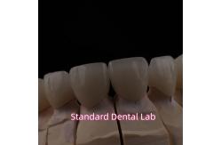 China PFZ Dental Layered Ceramic Zirconia Bridge With Incisal Translucent supplier