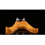 Ivoclar Digital Dental Implant Bar Denture with Attachments , Full Acrylic Titanium Implant Supported Dentures for sale