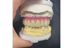 China Malo Bridge Hybrid Zirconia All On Four / Six Zirconia Implant Bridge TItanium Bar supplier
