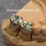 High Nobel Yellow Dental Gold Crowns Professional Ni Be Free ISO Approved for sale