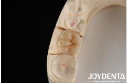 China High Translucency Full Zirconia With Layers Biocompatibility And Flexural Strength Of 800 MPa supplier