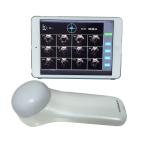 Portable 4D Wireless Bladder Scanner WIFI Ultrasound Probe for Evaluation of Residual Quality After Urination for sale