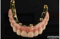 China Dental Prosthesis Ti-Bar Zirconia Hybrid Bridge With High Biocompatibility Standards supplier