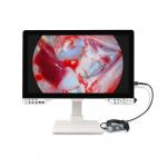 Innovative Full HD Surgical Endoscope Camera Kit With Light Source And 27'' Monitor For Gynecology for sale