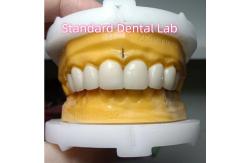 China Ivoclar Zirconia Crown Veneers High Translucency Esthetic supplier