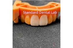 China High Colour Stability Ivoclar Emax Laminate Veneers High Translucency supplier