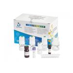 High Accuracy Male Fertility Test Kit 40T/Kit For Male Infertility Diagnosis for sale
