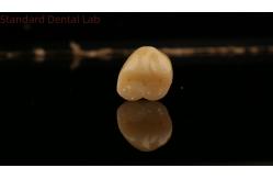 China Mill and Centring Full Zirconia Crown , China Dental Lab Fast Delivery supplier
