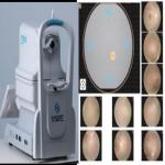 Portable Non Mydriatic Retinal Camera With 2.8mm Pupil DICOM & AI Manual Focus for sale