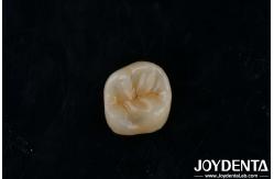 China Customizable Adhesive Zirconia Inlays Onlays High Translucency For Restoration supplier