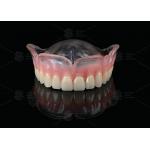 Vertex Clear And Pink Full Denture Virtually Unbreakable Affordable Partial Dentures for sale