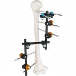Condylar External Fixation Device for sale