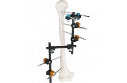 China Condylar External Fixation Device supplier