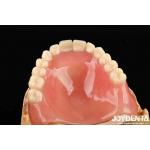 Good Elasticity Acrylic Denture Finish For Lightweight Personalized Customization And Customized Design