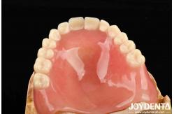 China Good Elasticity Acrylic Denture Finish For Lightweight Personalized Customization And Customized Design supplier