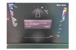 China  EPIQ 7 Report Error Ultrasound Machine Repair Replace ACQ Board supplier