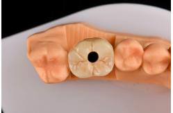 China 10mm Titanium Tooth Implant Sandblasted Self Tapping Dental Implants supplier