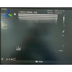  Sparq Ultrasound Machine Repair Abnormal Image Replace Channel Board 453561184013