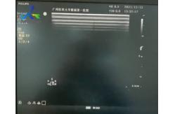 China  Sparq Ultrasound Machine Repair Abnormal Image Replace Channel Board 453561184013 supplier