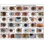 12 MP Iridology Iriscope Iridology Camera
