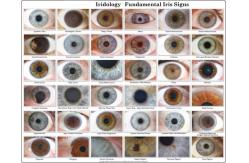 China USB Eye Iriscope Scanner / Iridology Camera Analyzer 12.00 Mega Pixels supplier