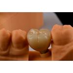 Oral Implantology Self Tapping Single Tooth Dental Implants With Internal Hex Connection for sale