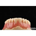 Good Elasticity Acrylic Denture Finish For Lightweight Personalized Customization And Customized Design