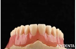 China Good Elasticity Acrylic Denture Finish For Lightweight Personalized Customization And Customized Design supplier