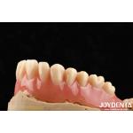Good Elasticity Acrylic Denture Finish For Lightweight Personalized Customization And Customized Design