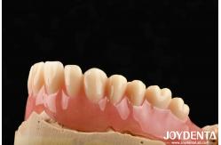 China Good Elasticity Acrylic Denture Finish For Lightweight Personalized Customization And Customized Design supplier