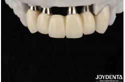 China Customizable Implant Crown And Bridge For Safe Oral Biocompatibility supplier