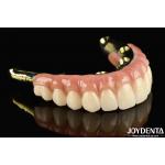 Say Goodbye To Missing Teeth With Zirconia Natural-looking And Durable for sale