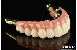 China Say Goodbye To Missing Teeth With Zirconia Natural-looking And Durable supplier
