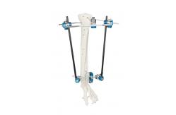 China SS Blue Ortho External Fixator Cross Clamp Class I Class III supplier