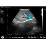 Hand Held Ultrasound Wireless 10mhz Doppler Probe