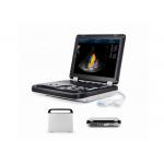 High Quality 2D Full Digital Color Doppler Machine For Pregnancy Test With Convex Probe for sale