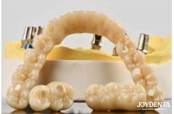 China Unmatched Accuracy Zirconia Implant Bridge Commitment To Comfort supplier
