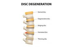 China Non Surgery Cervical Decompression Machine High Negative Pressure supplier