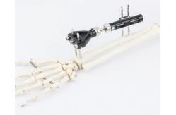 China CE / ISO Orthopedic External Fixator Trauma Sterilized Fracture Distal Radius supplier