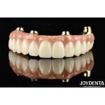 Functionality Ti-Bar Compatible With Natural Teeth And Gums Restores Chewing Function for sale
